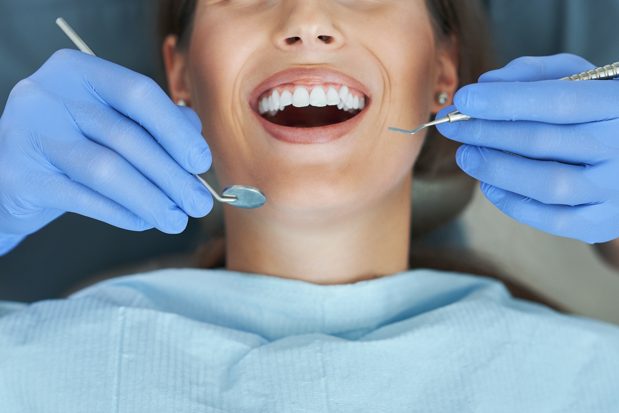 Root Canals - Brentwood Family Denitstry